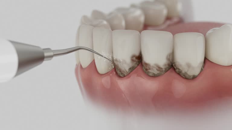 Trusted Dental Crowns And Bridges service in Crafton, PA - Dentist Open Now